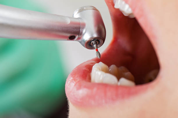 Best Dentist for Severe Toothache  in Harrison, NY